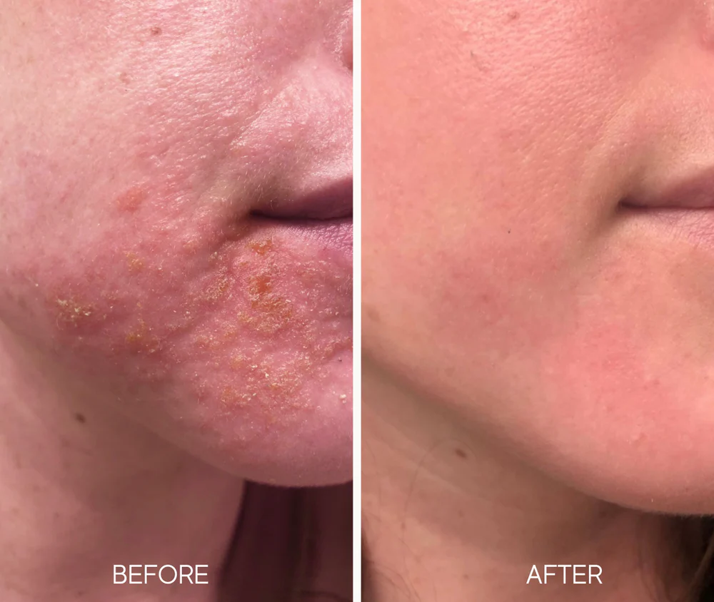 LUMIELLÉ - Glass Skin Liquid Exfoliant
