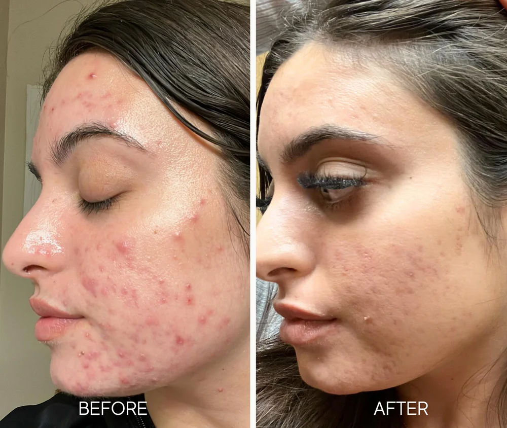 LUMIELLÉ - Glass Skin Liquid Exfoliant