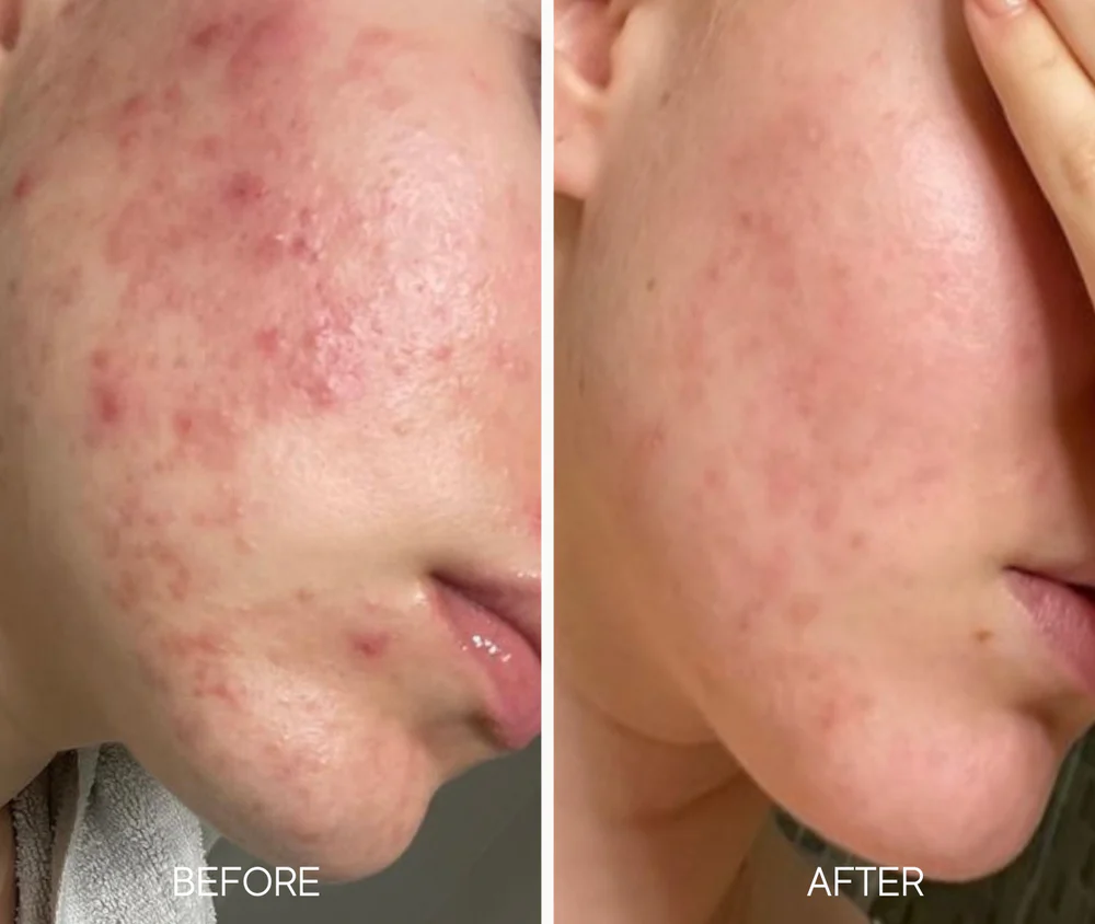 LUMIELLÉ - Glass Skin Liquid Exfoliant