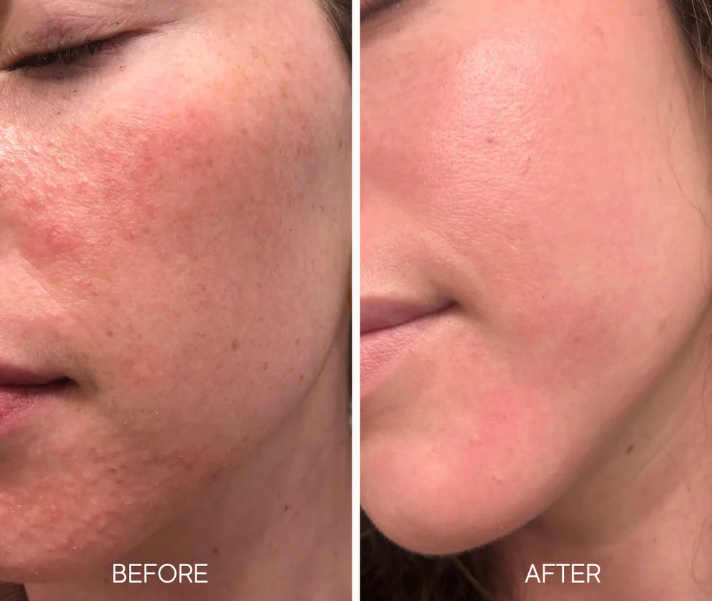 LUMIELLÉ - Glass Skin Liquid Exfoliant