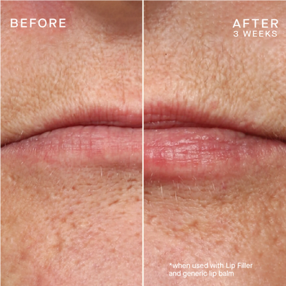 Ourself Lip Plumping - Your Best Lips Gift Set