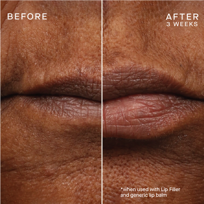 Ourself Lip Plumping - Your Best Lips Gift Set