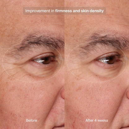 Pavise Precision Eye Lift