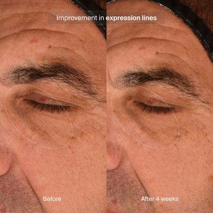 Pavise Precision Eye Lift