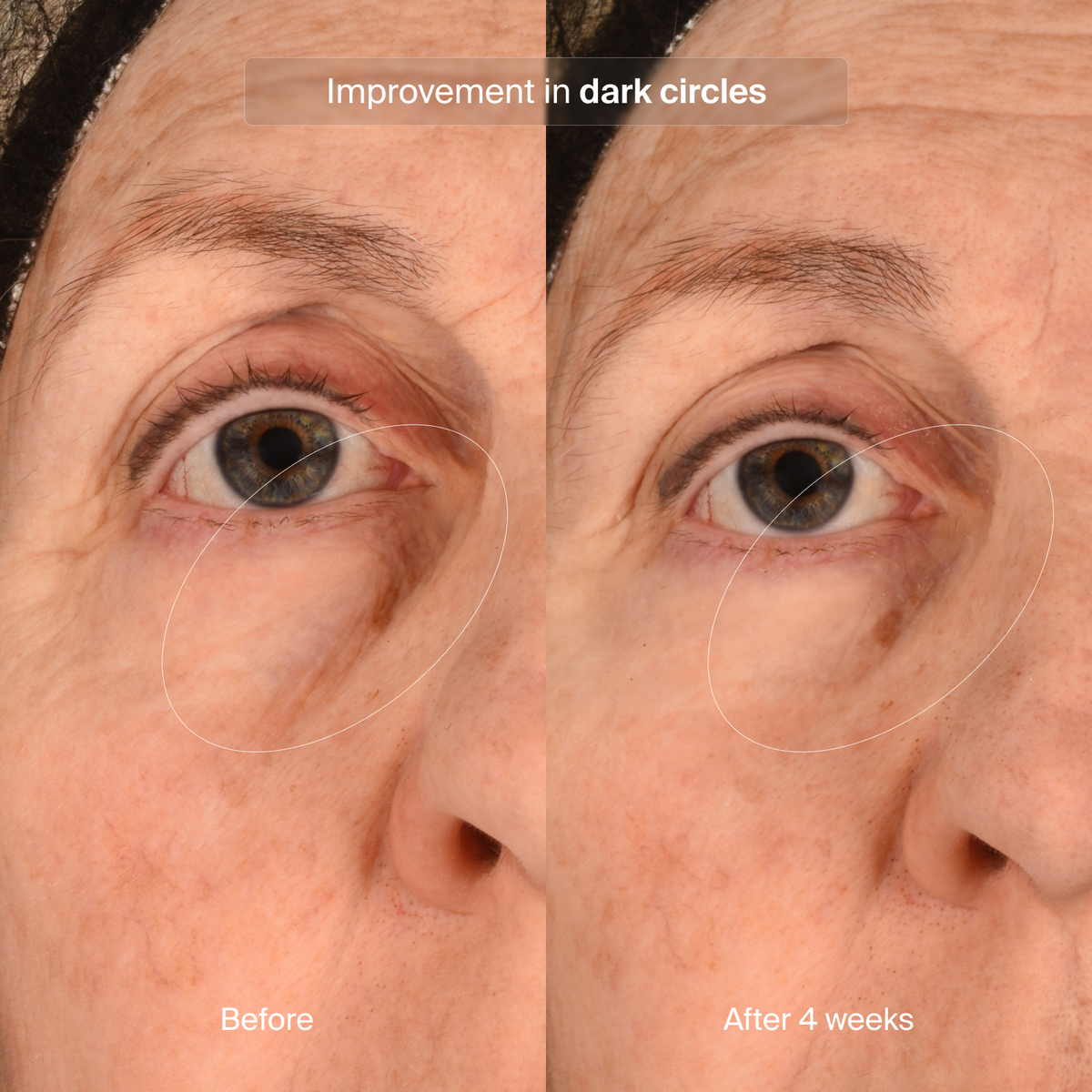 Pavise Precision Eye Lift