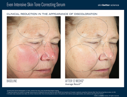 Skinbetter Even Intensive Skin Tone Correcting Serum