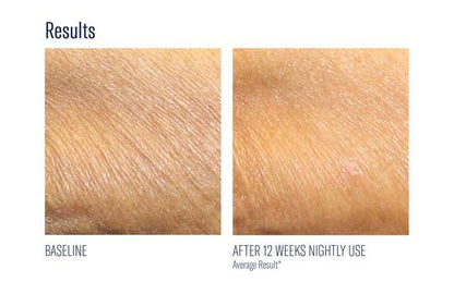 Skinbetter Alpharet BODY Overnight Cream