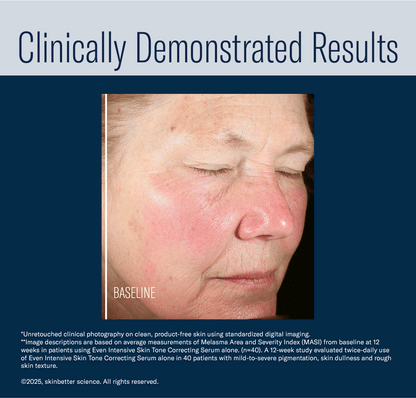 Skinbetter Even Intensive Skin Tone Correcting Serum